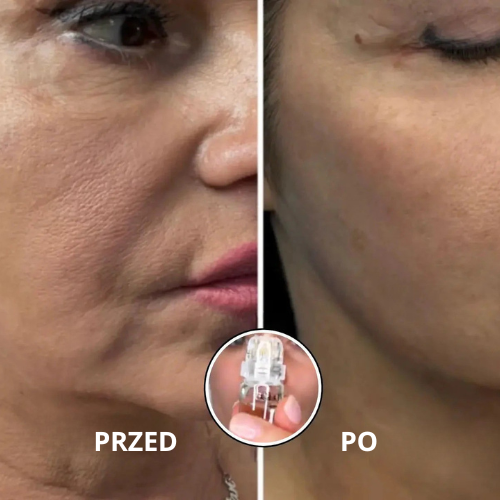 Serum mikroinfuzja twarzy RENEWAL™